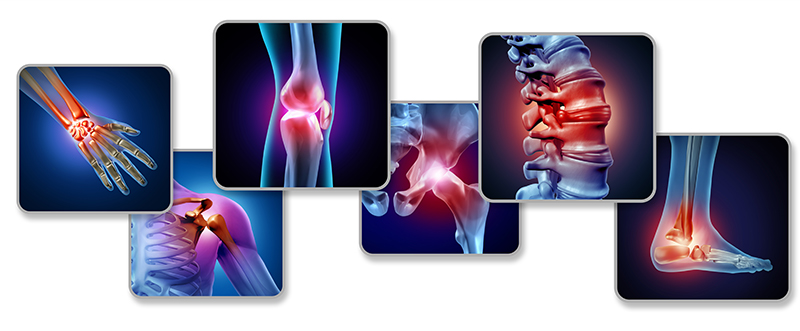 Joint Pain Management